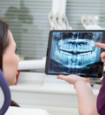 Digital X-Rays