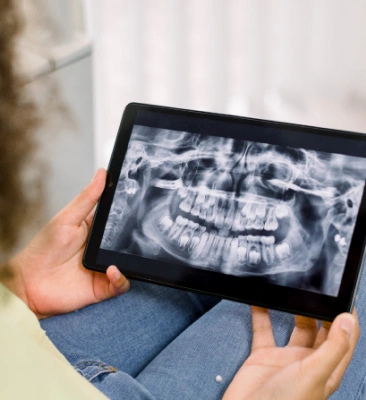 Panoramic X-Ray