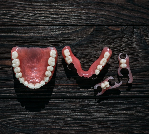 A Flexible Solution for Multiple Missing Teeth
