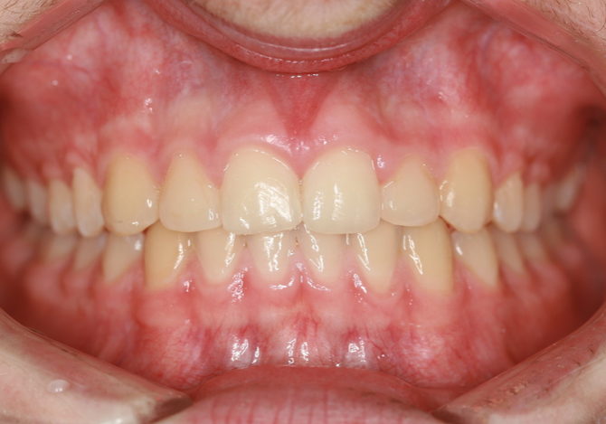 post_op_ortho_Tucker Post-Op Orthodontics